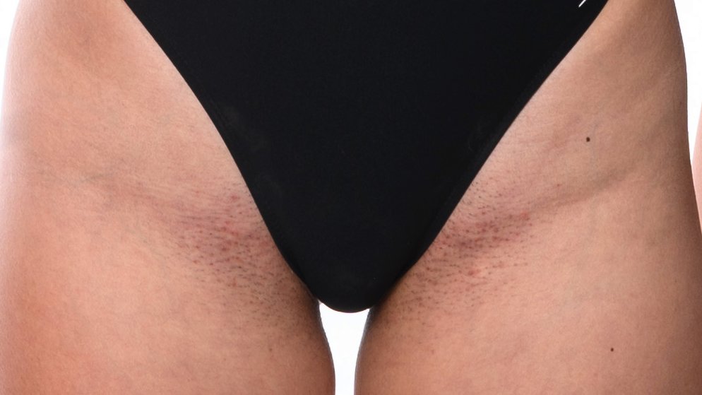 Swimsuit crotch zoom